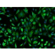 Mouse Pulmonary Alveolar Epithelial Cells (MPAEpiC) - Immunostaining for CK-18, 200x

