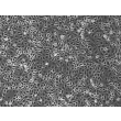 Mouse Pulmonary Alveolar Epithelial Cells (MPAEpiC) - Phase contrast, 100x
