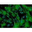 Mouse Renal Mesangial Cells (MRMC) - Immunostaining for α-SMA, 200x.
