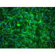 Mouse Schwann Cells (MSC) - Immunostaining for S100-β, 200x.

