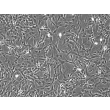 Rabbit Astrocytes (RabA) – Phase Contrast, 100X.
