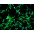 Rabbit Cardiac Fibroblasts (RabCF) – Immunostaining for FN, 200x.