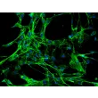 Rabbit Pulmonary Fibroblasts (RabPF) – Immunostaining for FN, 200x.
