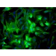 Rabbit Renal Proximal Tubule Epithelial Cells (RabRPTEpiC) – Immunostaining for CK-18, 200X.
