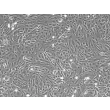 Rabbit Renal Proximal Tubule Epithelial Cells (RabRPTEpiC) – Phase Contrast, 100X.
