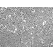 Rat Aortic Smooth Muscle Cells (RASMC) – Phase contrast, 100x
