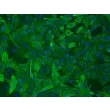 Rat Aortic Smooth Muscle Cells (RASMC) – Immunostaining for α-sma, 200x
