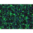 Rat Astrocytes (RA) - Immunostaining for GFAP, 200x.
