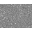 Rat Brain Microvascular Endothelial Cells - Phase contrast, 100x.