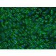 Rat Brain Microvascular Endothelial Cells (RBMEC) – Immunostaining for vWF, 200x.