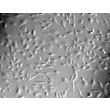 Rat Cardiac Fibroblasts (RCF) - Relief contrast, 100x.