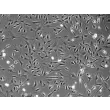 Rat Cardiac Fibroblasts (RCF) - Phase contrast, 100x.