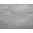 Rat Cerebellar Granule Cells (RGC) - Relief contrast, 100x.
