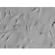 Rat Embryonic Fibroblasts (REF) - Relief contrast, 400x.
