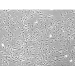Rat Hepatic Stellate Cells (RHSteC) - Phase Contrast, 100x
