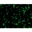 Rat neurons - cortical (R1520) - Immunostaining for Beta Tubulin III, 200x