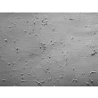 Rat Neurons-hippocampal (RN-h) - Relief contrast, 100x.
