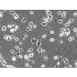Rat Neurons-striatal (RN-s) - Phase contrast, 200x.
