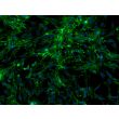 Rat Perineurial Fibroblasts (RPNF)- Immunostaining for FN, 200X.
