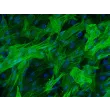 Rat Pulmonary Artery Smooth Muscle Cells (RPASMC) - Immunostaining for α-smooth muscle actin, 200x