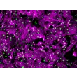 Rat Renal Mesangial Cells (RRMC) - Immunostaining for α-SMA, 100x.
