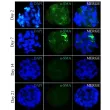 IF shows significant reduction in a-SMA expression after a week in 3D culture