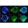 Immunostaining of the human pulmonary alveolar epithelial cell spheroids with the epithelial cell marker CK18 and the specific alveolar epithelial cell type II marker SP-C. 