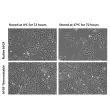 The bFGF Thermostable exhibits superior activity compared to native bFGF.  Native (left) bFGF and rhbFGFTS (right) solutions were stored at 4°C (unstressed) or 37°C (heat stressed) for 72 hours before being used to treat the HUVEC cell. 