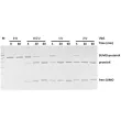 Representative gel picture of SUMO protease activity test. A 100 ug of target SUMO-protein was incubated with various amount of SUMO protease (Ulp1) in a buffer containing 50 mM Tris-HCl (pH 8.0), 150mM NaCl, 0.2% NP-40 and 1mM DTT at 30 ℃.
