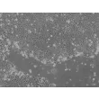 人胚胎干细胞（hESC）在STEMium™中生长——相差显微镜观察（100×）。
