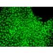 人胚胎干细胞（hESC）在STEMium™中生长——NANOG免疫染色（绿色），200×。
