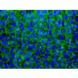 hiPSC grown in STEMium – Immunostaining for SSEA4 (green), DAPI (blue), 400x.
