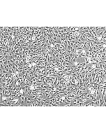 人类关节软骨细胞 (HC-a) - 相差显微镜，100倍放大。