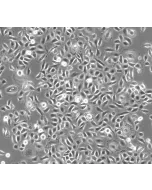 人类小气道上皮细胞（HSAEpiC）- 相差显微镜 100x