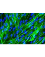 人类肺动脉平滑肌细胞 [HPASMC] - α-SMA 的免疫染色，400倍