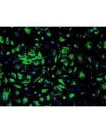 人类肾小球内皮细胞（HRGEC）- 免疫染色，标记 vWF，200倍显微镜放大。
