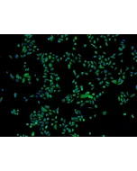 
人类表皮角质形成细胞-胎儿 (HEK-f) - CK-18 免疫染色，100x。