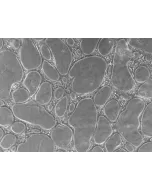 Cells day 4 of assay, 100x (day 4 cond1-10x)
