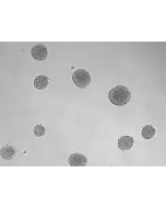 Development of 3D osteoblast spheroid at days 3 (taken at 100x magnification). 