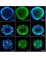 Human Cortical Spheroids at Day 7