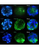 Immunostaining of the co-culture spheroids with the stellate cell markers (Vimentin and Smooth Muscle Actin) and the endothelial cell marker Von Willebrand Factor.