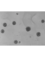 Day 5: Osteoblast and endothelial cells co-culture spheroids
