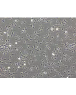 Phase Contrast Caption: Bovine Astrocytes (BA)- Phase Contrast, 100x
