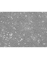 Bovine Brain Microvascular Endothelial Cells (BBMEC) - Phase contrast, 100x