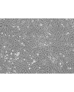 Bovine Brain Microvascular Endothelial Cells (BBMEC) - Phase contrast, 100x
