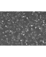 Bovine Dermal Fibroblasts (BDF)-Phase contrast, 100x