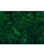 Bovine Meningeal Cells (BMC)-Immunostaining for FN, 200X