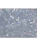 Bovine Iris Pigment Epithelial Cells (BIPEpiC)-Phase Contrast, 100X