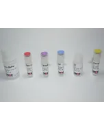 Glucose-6-phosphate Dehydrogenase Assay