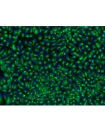 HPSC-Derived Neural Stem Cells (H9-NSC) – Immunostaining for Nestin, 200x